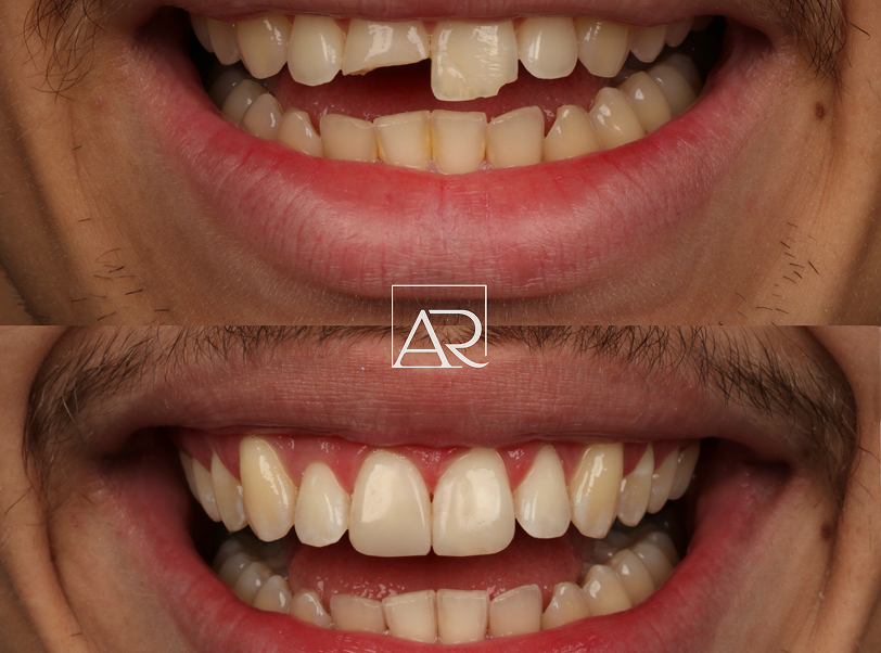 Cirurgia e traumatologia - 3