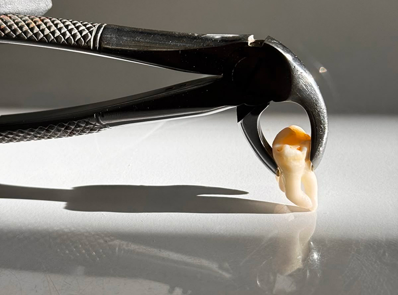 Cirurgia e traumatologia - 4